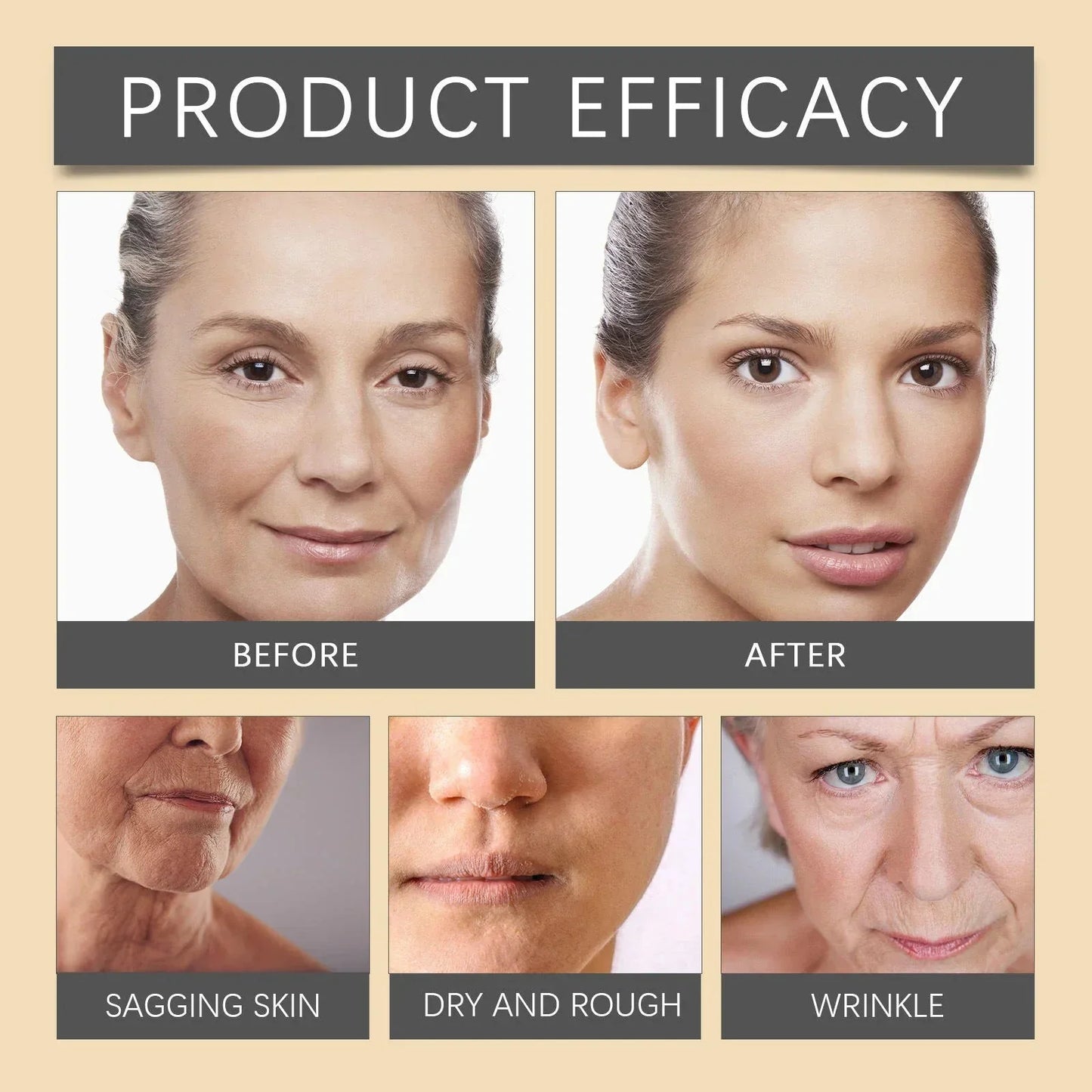 Botox Bee Venom Wrinkle Removal Cream ( Buy 1 Get 1 Free )